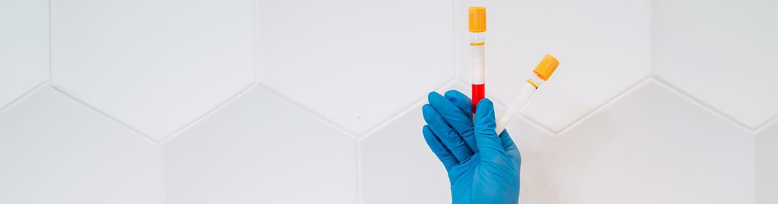 Drogentests zur Nachweisbarkeit von Cannabis können in Form von Blut-, Urin-, Haar- oder Speichelproben durchgeführt werden, wobei die Nachweiszeiten variieren.